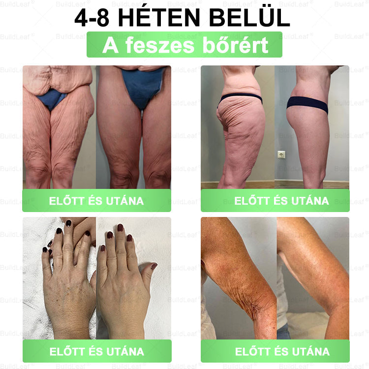 𝖡𝗎𝗂𝗅𝖽𝐿𝑒𝑎𝑓® GLP-1 8 az 1-ben Fit & Vital Szájon át szedhető oldat – Napi egyszer, 7 nap alatt látható változás / Elhízás, szív- és érrendszeri egészség, cukorbetegség, alvási apnoe, bélrendszer egészsége, ízületi problémák és még sok más esetén.🧪